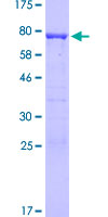 12.5% SDS-PAGE Stained with Coomassie Blue.